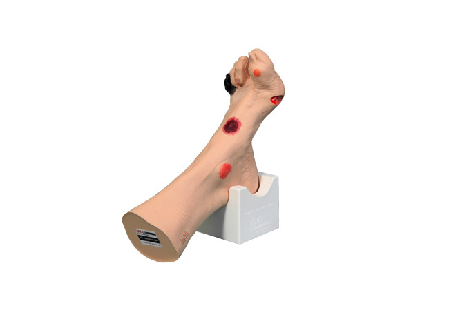 G-CM2718-Wilma-Wound-Foot-Model